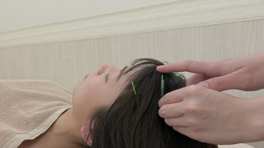 豊橋女性薄毛専門治療