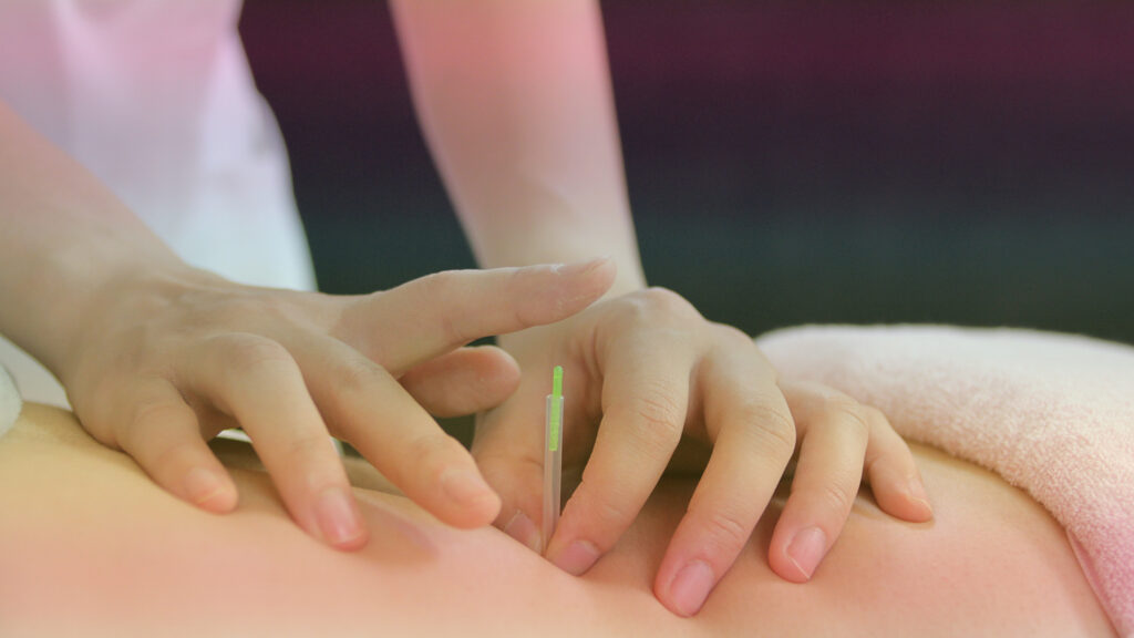 豊橋子宮内膜症治療