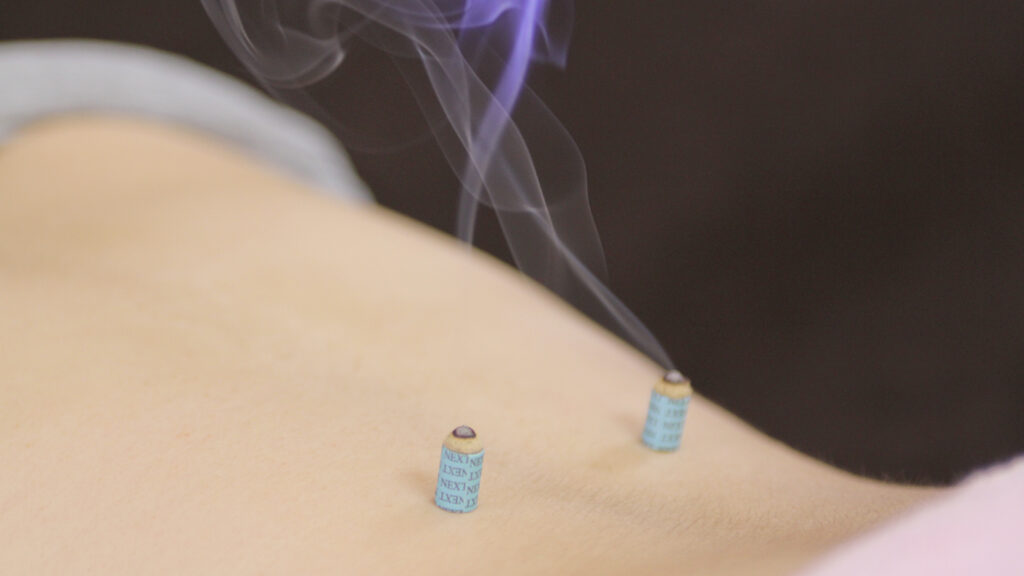 豊橋線維筋痛症治療