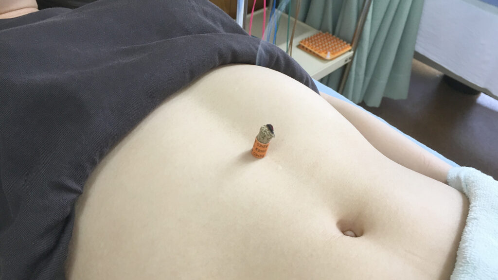 豊橋拒食症治療